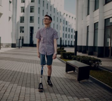 Man with right leg prosthesis walking on sidewalk in city.